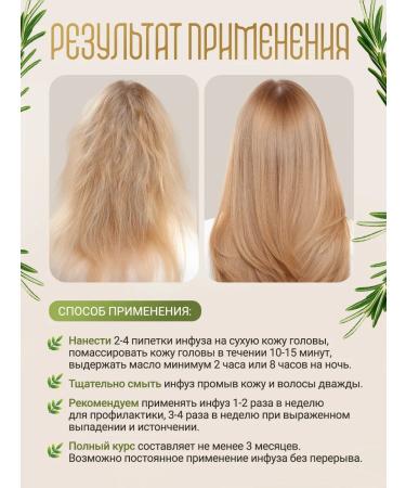 RASTIKULA Rosemary oil for hair growth 100 ml - Buy Online on GoSupps.com