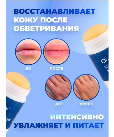 Topshop Cream from cracks on the feet of the arms of the elbows moisturizing in the stick - Buy Online on GoSupps.com