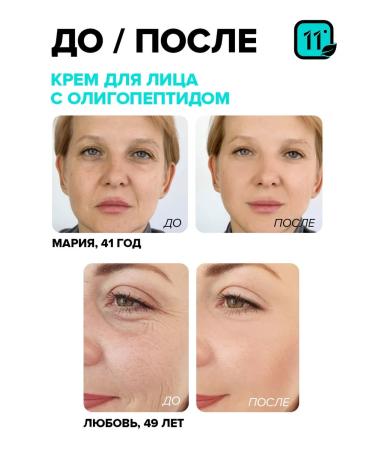 11i professional Face cream moisturizing anti -aging nutritional Korea - Buy Online on GoSupps.com