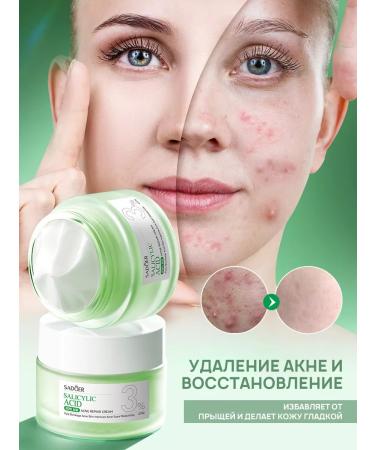 PrettyGirl Facial cream for acne with salicylic acid 50 ml - Buy Online on GoSupps.com