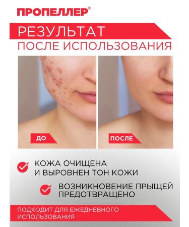 PROPELLER Azelic acid acne pimples+zinc - Buy Online on GoSupps.com