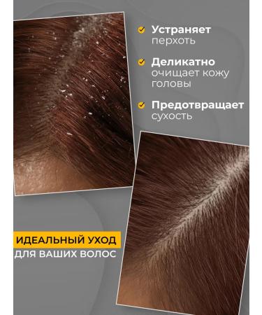 JoceJoli Remed for dandruff - Buy Online on GoSupps.com