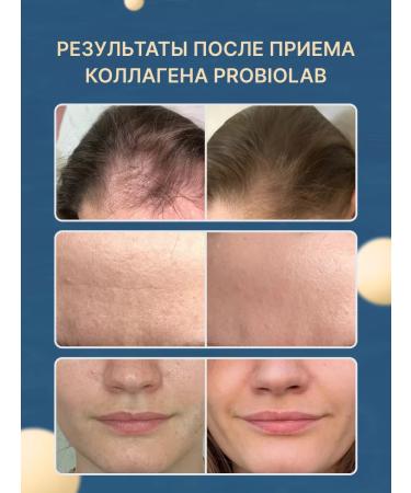 PROBIOLAB Collagen Sea drinking 500 ml - Buy Online on GoSupps.com