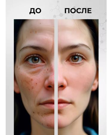 ZenWay Anti -aging serum for the face with retinol moisturizing - Buy Online on GoSupps.com