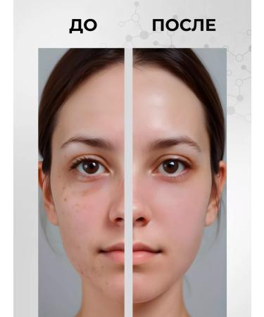 ZenWay Facial serum from acne and acne with niacinamide - Buy Online on GoSupps.com