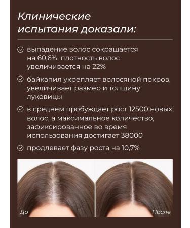 NappyClub Belly Mom hair growth mask - Buy Online on GoSupps.com