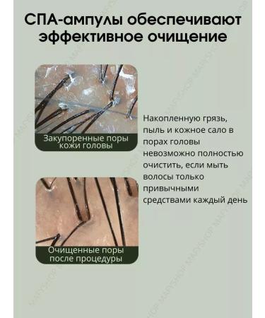 MackAndy Scalp scrub - Buy Online on GoSupps.com