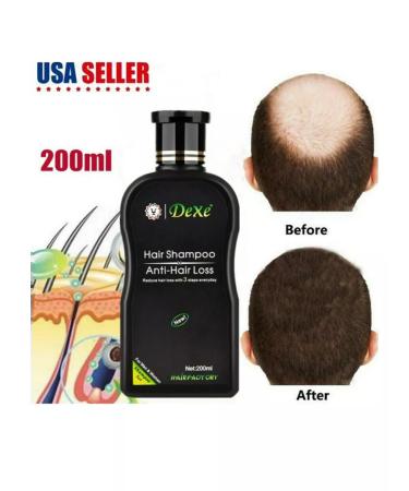 Dexe Hair shampoo 200 ml - Buy Online on GoSupps.com