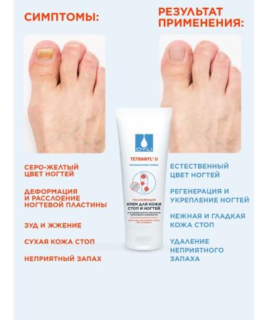 OYLI Cream from fungus for feet and heels cosmetics for the legs and nails - Buy Online on GoSupps.com