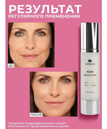 Matrigen Face cream 50 ml of Korea - Buy Online on GoSupps.com