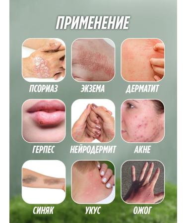 KATTY YUZ Chinese miracle mask from acne psoriasis dermatitis acne - Buy Online on GoSupps.com