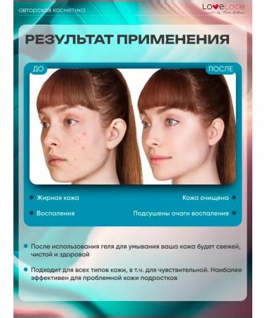 TashaGalkina Washing gel for problem skin - Buy Online on GoSupps.com