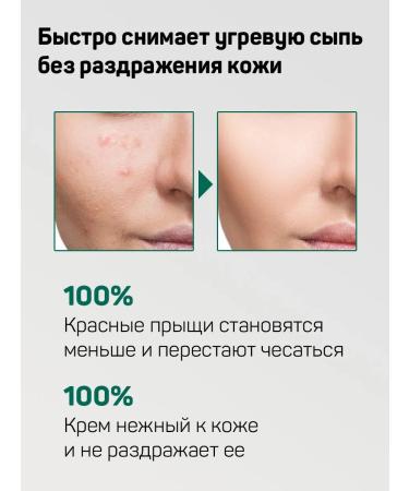 Some by mi Face moisturizer from acne matting - Buy Online on GoSupps.com