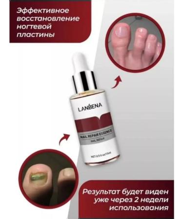 Nail fungus agent 2 pieces - Buy Online on GoSupps.com