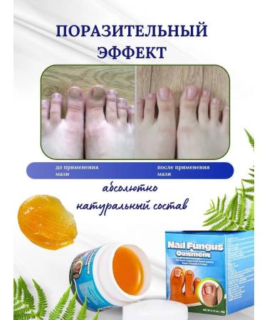 callus stick Chinese remedy for nail fungus 20 g - Buy Online on GoSupps.com