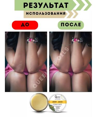 Queen of Oils Cream for legs and arms from cracks and dryness - Buy Online on GoSupps.com