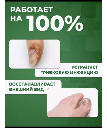 creams Chinese remedy for nail fungus 30 ml - Buy Online on GoSupps.com