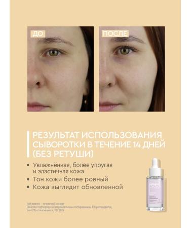 Feel the Moment Moisturizer to the face with retinol and niacinamide - Buy Online on GoSupps.com