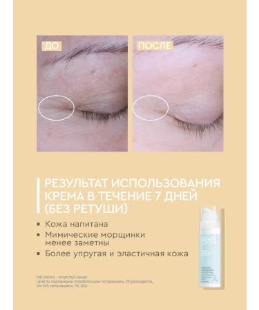 FEEL MOMENT Moisturizing face with retinol and niacinamide 50 ml - Buy Online on GoSupps.com