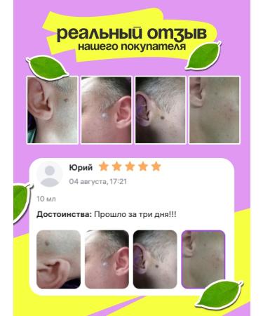 Alfit Plus Set cream gel papillomafit 2 pcs. from papillomas and warts - Buy Online on GoSupps.com