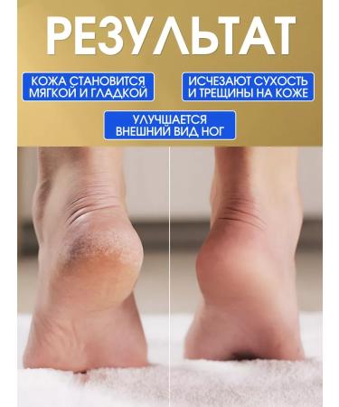 Yoko Feet cream from cracks and corns 50 g - Buy Online on GoSupps.com