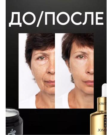 Zozu Serum and cream set - Buy Online on GoSupps.com