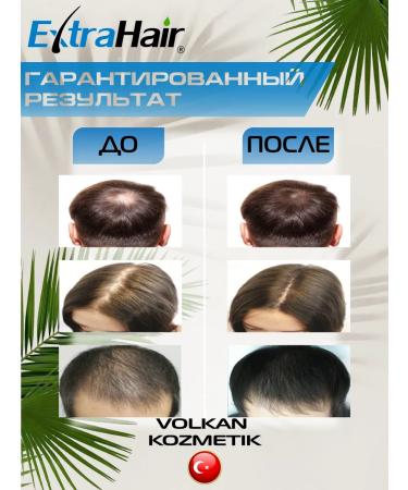Extra Hair Volkan Kozmetik EXTRAHAIRA serum + SELEREX HEALTY OF ALSU - Buy Online on GoSupps.com