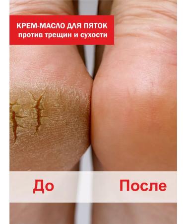 Fly agaric against Cream oil for heels from cracks and dryness - Buy Online on GoSupps.com