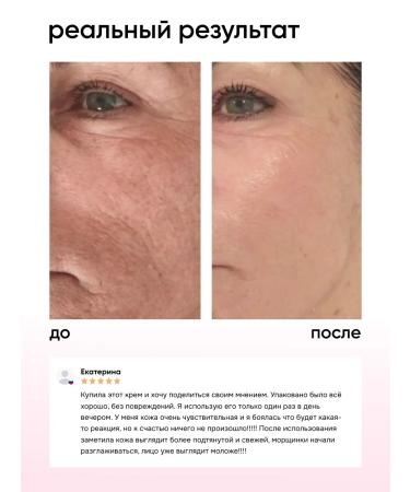 BACK TIME Retinol cream - Buy Online on GoSupps.com