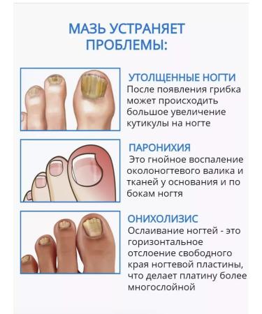 JUMEYRAH Chinese remedy for nail fungus 20 g - Buy Online on GoSupps.com