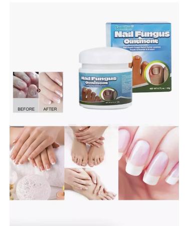 JUMEYRAH Chinese remedy for nail fungus 20 g - Buy Online on GoSupps.com