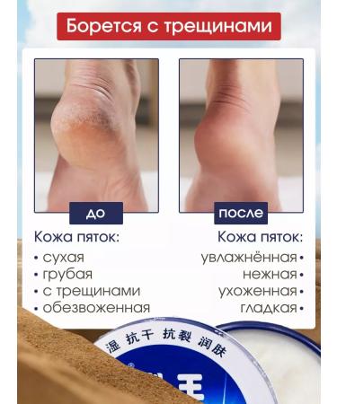 HAPPY CARROT Cream for very dry skin - Buy Online on GoSupps.com