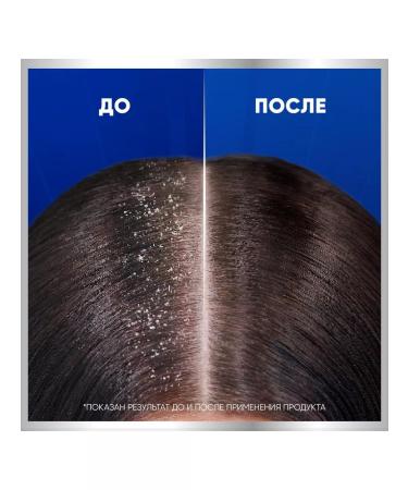 Head&Shoulders Shampoo from dandruff 7B1 against persistent dandruff 300 ml - Buy Online on GoSupps.com