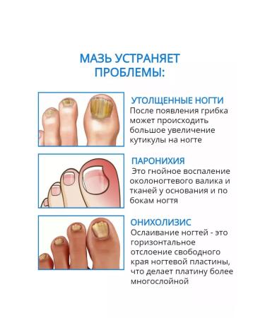 Chinese remedy for fungus Chinese remedy for nail fungus 20 g - Buy Online on GoSupps.com