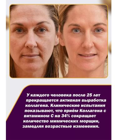 IOFFE Sea collagen capsule for joints - Buy Online on GoSupps.com