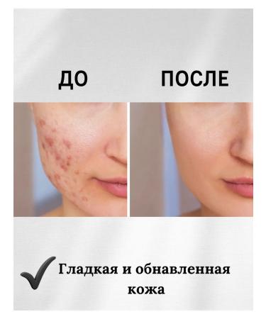 Isntree Active smoothing serum with retinol - Buy Online on GoSupps.com