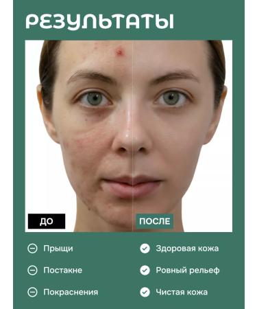 LEBIVOL Wede-gel for the face and body from acne and acne - Buy Online on GoSupps.com