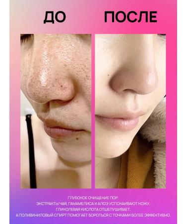 PrettyGirl Cleaning strips for the nose of black dots 10 pcs - Buy Online on GoSupps.com