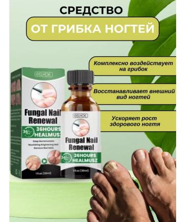 GT MARKET Nail fungus remedy