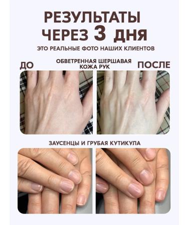 Bonimed Cream of wax from cracks with urea 10% set - Buy Online on GoSupps.com