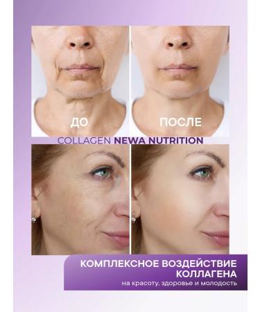 Newa Nutrition Peptide Beauty Collagen with Hondoprotector - Buy Online on GoSupps.com