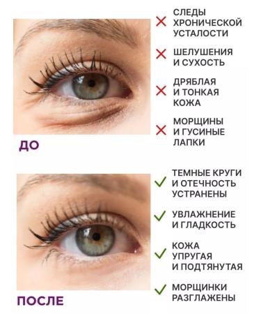 HQ Vegan from edema and bags of patches natural for the eyes - Buy Online on GoSupps.com