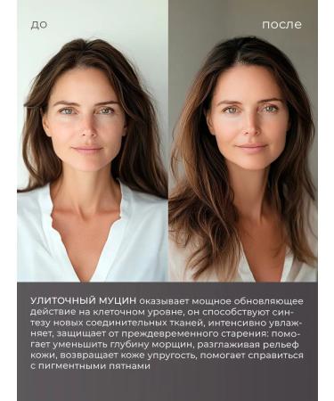 EKEL Face cream against wrinkles with snails and gold - Buy Online on GoSupps.com