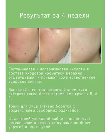 Celimax Facial Toner Thel Noni Moisture Balance Toner - Buy Online on GoSupps.com