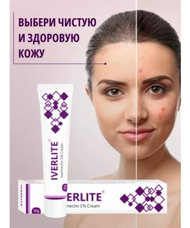 PEROLITE Facial cream from acne and rosacea Iverlaite - Buy Online on GoSupps.com
