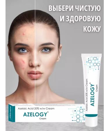 PEROLITE Facial cream from acne acum - Buy Online on GoSupps.com