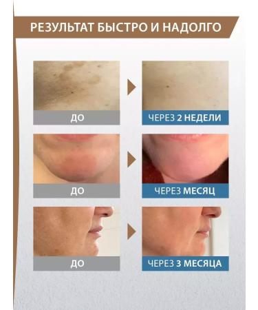 DUCRAY Cream concentrate against pigmentation for all skin types - Buy Online on GoSupps.com