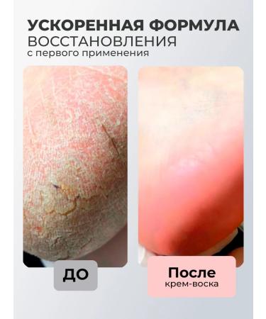 ROSILAK Cream mask set from cracks of serum two-phase for nails - Buy Online on GoSupps.com