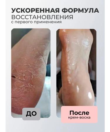 ROSILAK Cream mask set from cracks of serum two-phase for nails - Buy Online on GoSupps.com