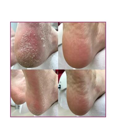 ROSILAK Cream-mask for legs Feeling Cream-Mask - Buy Online on GoSupps.com